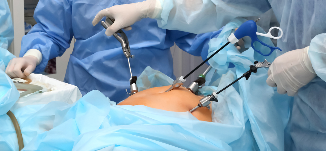 Slider-Laparoscopic-Cystectomy.jpg